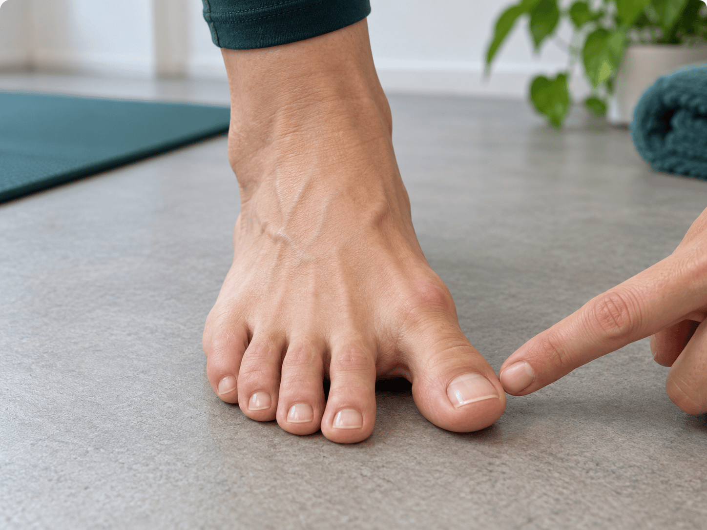 Aktive Bewegung der Großzehe von der zweiten Zehe weg bei mildem Hallux valgus